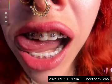 Ahegao, Spit, Braces, Saliva, Messy..., braces 13